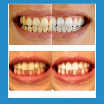 10ML Perle Naturale Dinte Periaj Lichid Fizice Dinți Unghii Detoxifiere si Albire Orale Dentare, Igiena Orală
