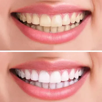 Adult Sănătate Periuta De Dinti Nailon Cărbune Perie Perie De Dinti Îngrijire Orală Igienă De Curățare Dinți, Periuță De Dinți